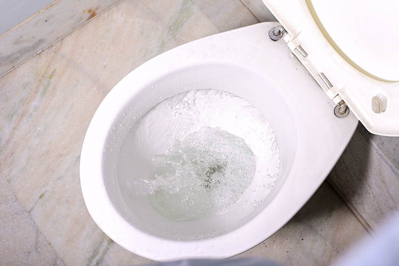 Is Chromhidrosis Behind Your Blue Toilet Seat?