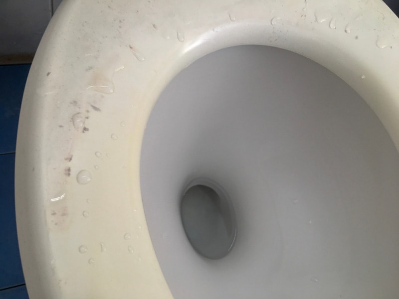 why-is-there-mold-in-my-toilet-bowl-6-likely-reasons-house-grail